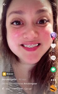 past memory braces filter on tiktok